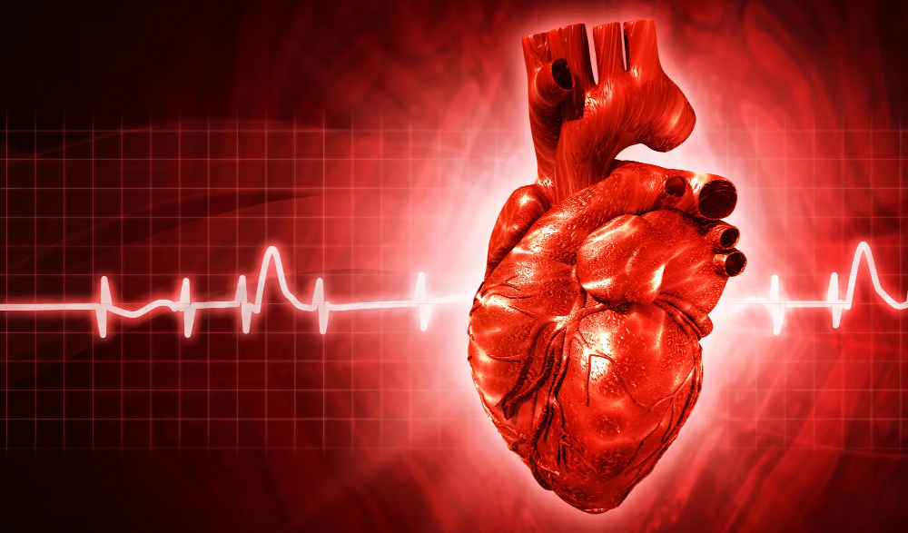 arrhythmia.jpg